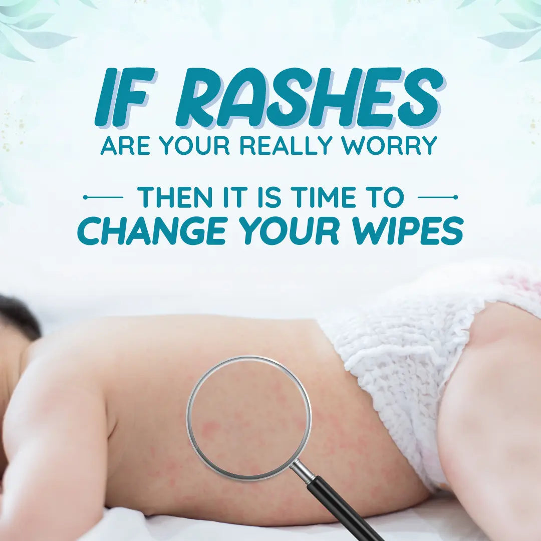 best baby wipes in India Clinically Proven to be effective on rashes 0106