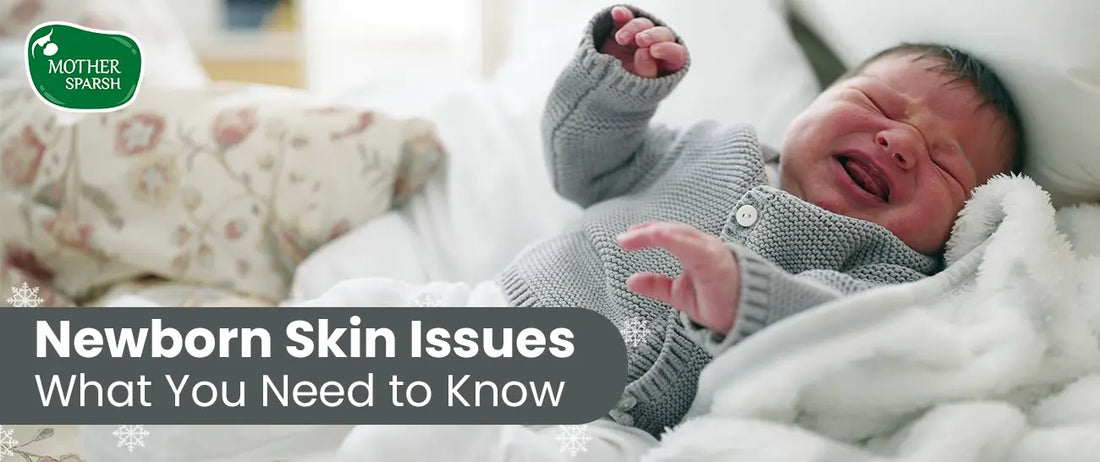 Skin Problems in Newborns: Common Skin Issues and Effective Solutions