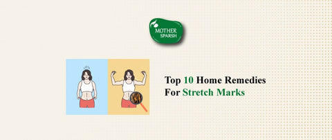 Top 10 Home Remedies for Stretch Marks