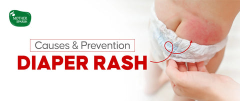 Diaper Rash in Babies: Causes, Prevention & Daily Care Tips