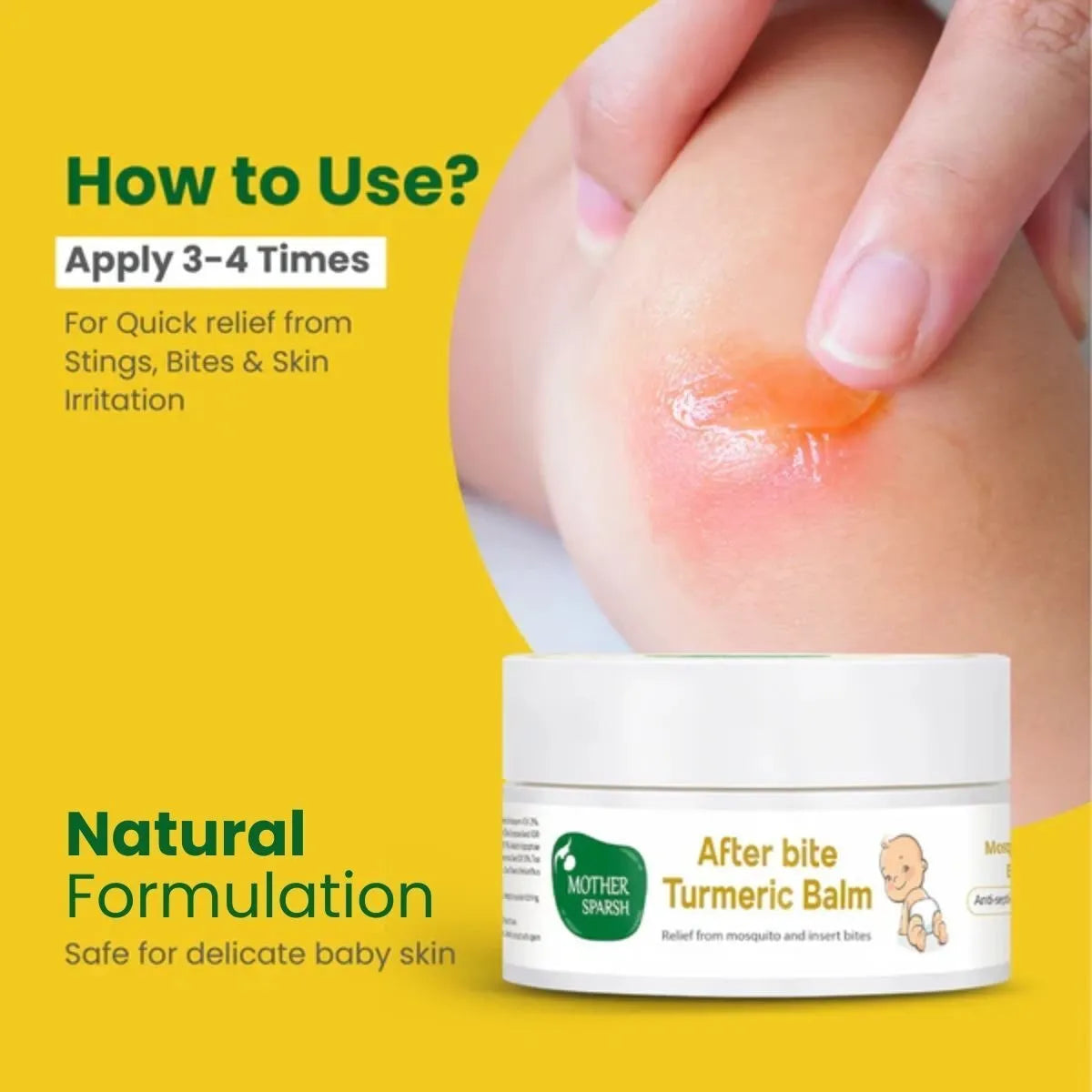 Calming relief from stings bites & skin irritation safe for delicate baby skin