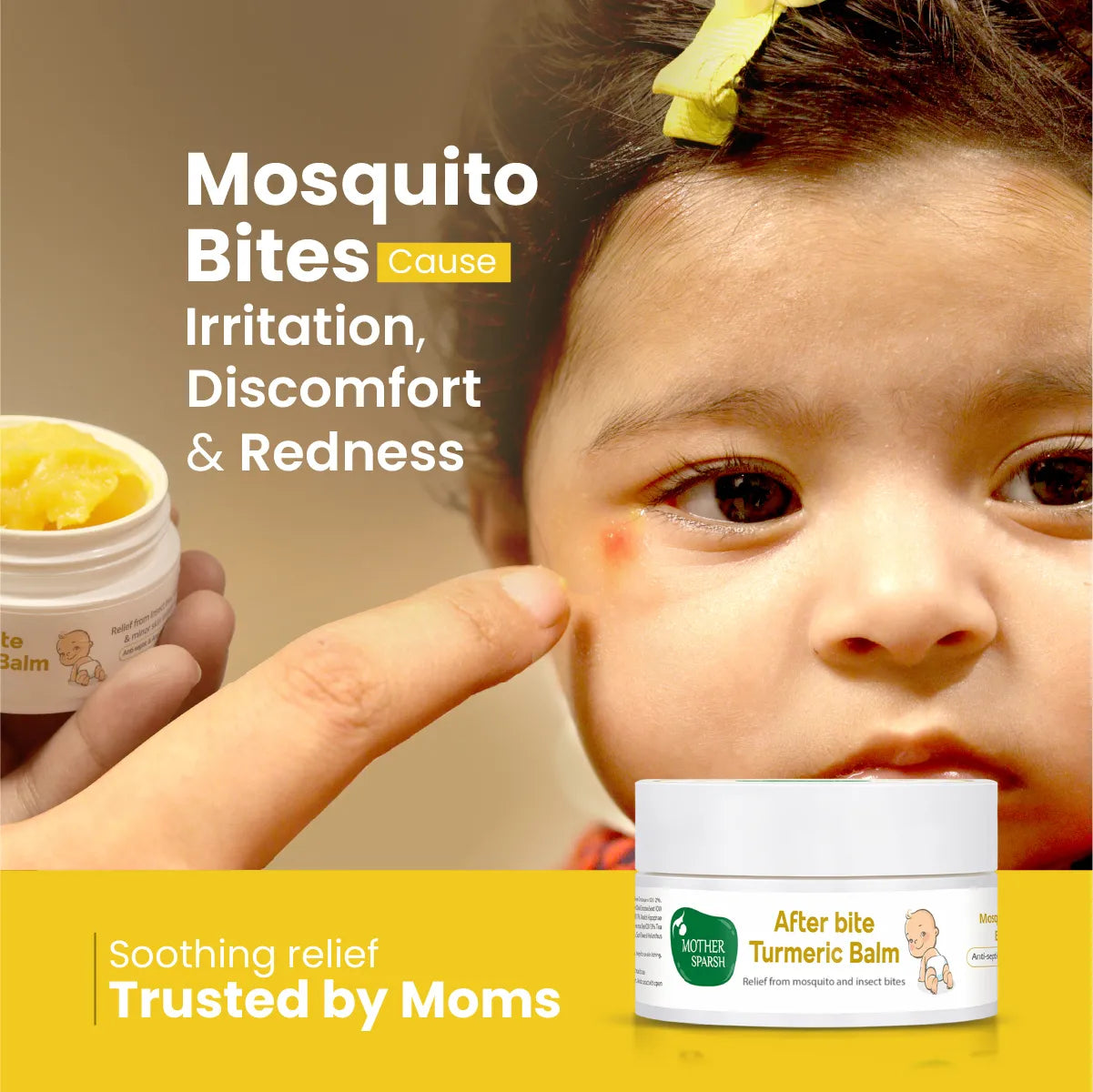 Soothing relief for irritation discomfort redness because of mosquito bites