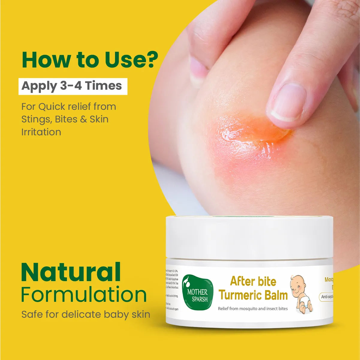 Calming relief from stings bites & skin irritation safe for delicate baby skin