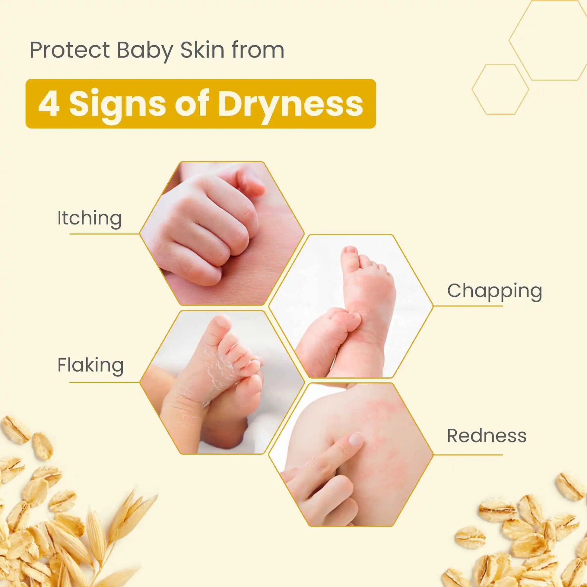 Protect Baby Skin from 4 Signs of Dryness